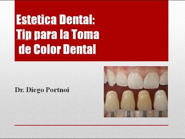 Estetica Dental: Tip para la Toma de Color Dental