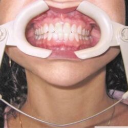 dentaltvweb abrebocas orthotechnology