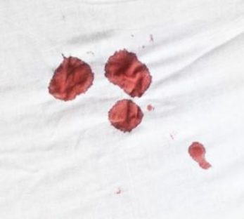 dentaltvweb manchas de sangre como eliminarlas