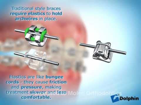 Sistema Damon- Animacion