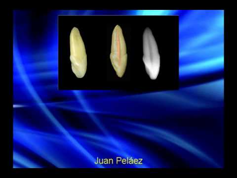 Anatomia Dental Interna 1ra- Parte