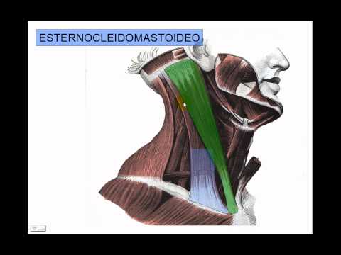 Musculos de cabeza y cuello, Esternocleido Mastoideo