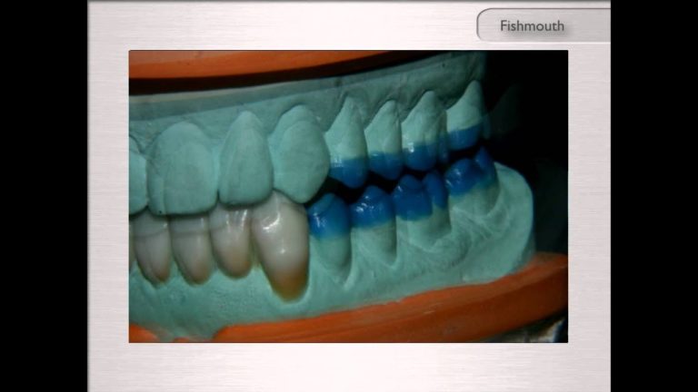 Encerado Diagnostico de Construccion Progresiva