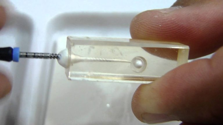 FACIL COLOCACION DEL HIDROXIDO DE CALCIO EN TRATAMIENTOS DE ENDODONCIA