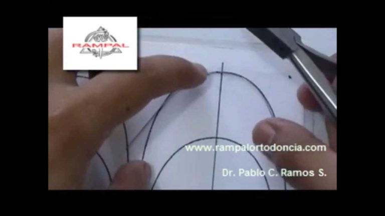 Conformacion y Diseño de Arco Ortodoncico Dental con Alambre Redondo