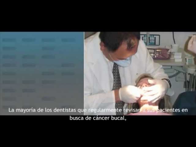 Lampara de deteccion de cancer bucal para inspeccion bucal