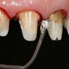 agentes hemostaticos icono dentaltvweb