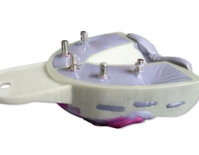 dentaltvweb-cubetas_para_implantes_2