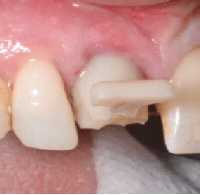 dentaltvweb gcl system