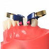 dentaltvweb matrices dentales icono