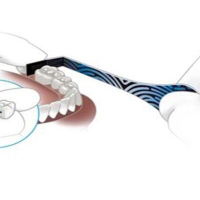 dentaltvweb papel de articular proxi-check