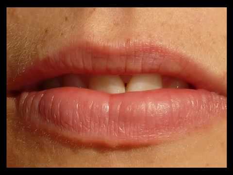 5 Signos que pueden detectar un cancer oral