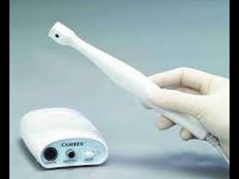 Como saber si la Camara Intraoral que tengo o la que voy a comprar “es buena”