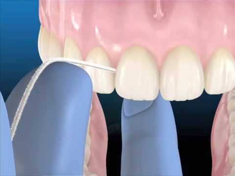 Tecnicas de higiene dental Complementarias