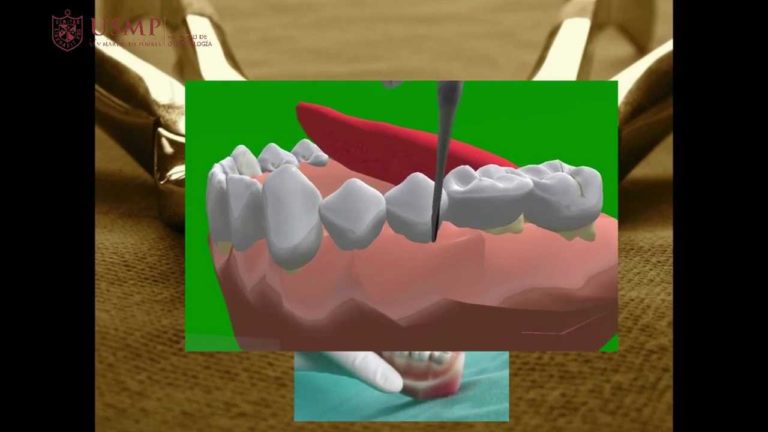 Manual de Exodoncia Dental