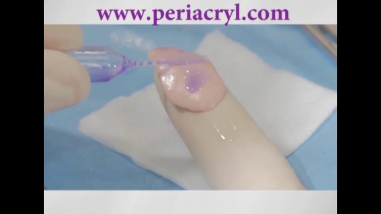 Injerto de tejido conectivo