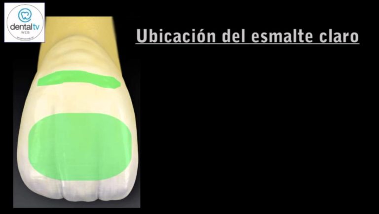 Mapa del color dental