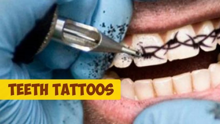 Tatuajes dentales