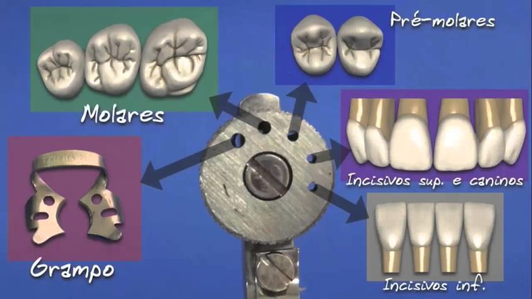 Aislamiento dental absoluto