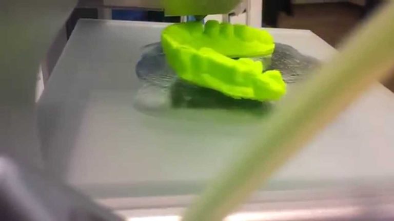 Impresión 3d dental