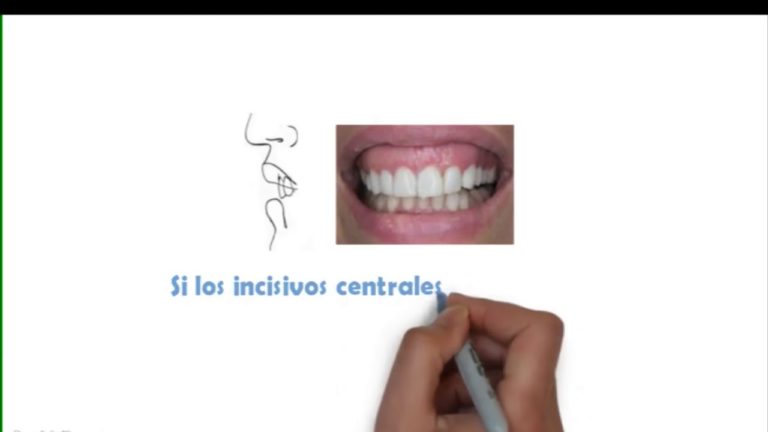 Tips sobre como saber el largo de los incisivos centrales superior