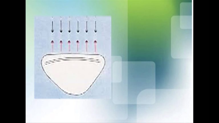 Como hacer que un diente parezca mas ancho de lo que es