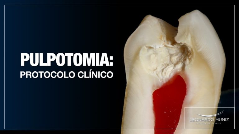 Pulpotomia dental Protocolo Clinico