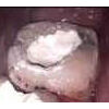 pasta provisoria dentaltvweb
