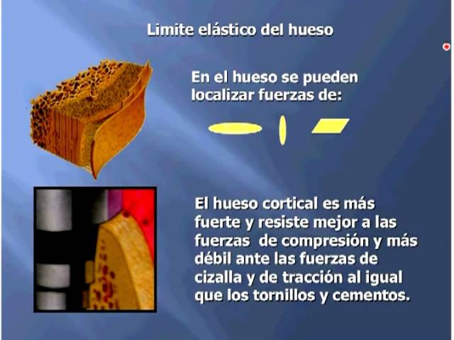 Biomecanica, ciencia que hace exitosa la Rehabilitacion Protesica