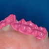 silicona dental para mordida