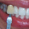 color dental icono dentaltvweb