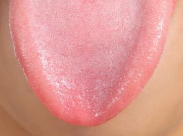 lengua dentaltvweb