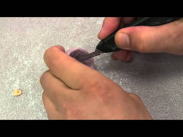 Como hacer una protesis parcial temporaria muy rapido en el consultorio. Paso a Paso