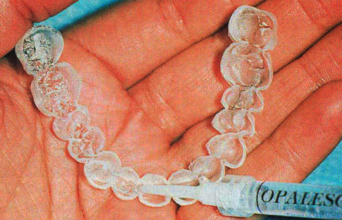 ferulas blanqueadoras