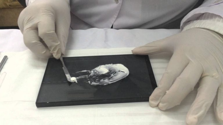 Tecnica de preparacion del Cemento Dental de Fosfato de Zinc