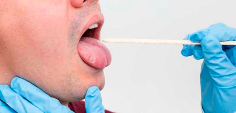 test-de-saliva-para-coronavirus