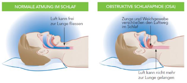 Von Karies bis Schlafapnoe: Zahnärzte können eine neue Rolle bei der Lebensrettung übernehmen