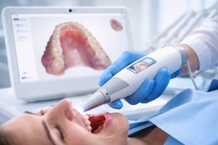 scanner intraoral 1