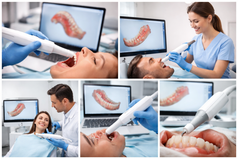 Guía de escaneo intraoral (Parte 10): cómo finalizar y validar el escaneo