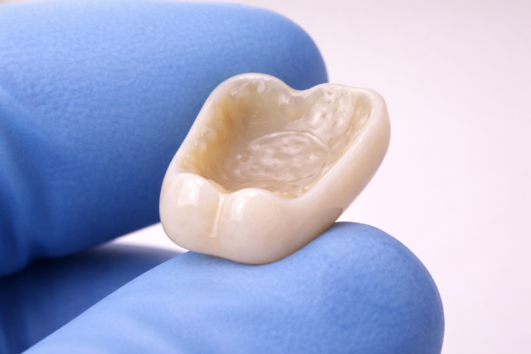 Adhesión a zirconia — protocolo clínico