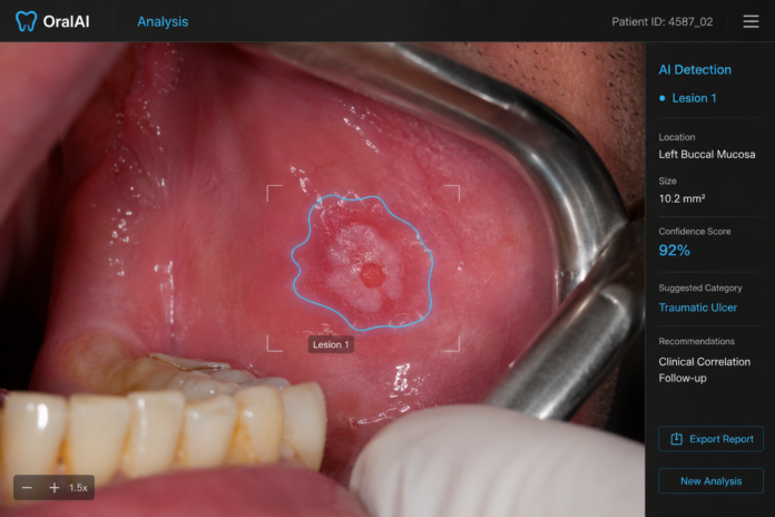 cancer oral