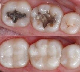 restauracion y estetica