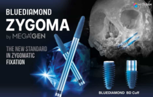 BLUEDIAMOND ZYGOMA