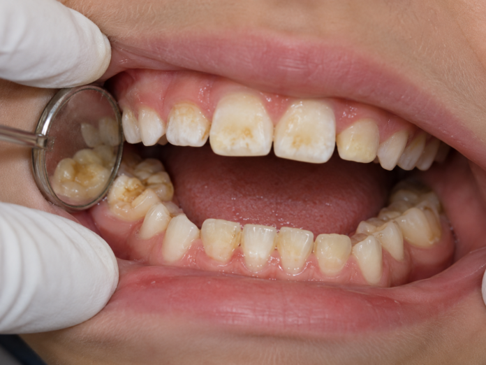 Examen dental pediátrico de cerca